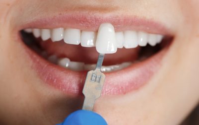 dentist-white-teeth