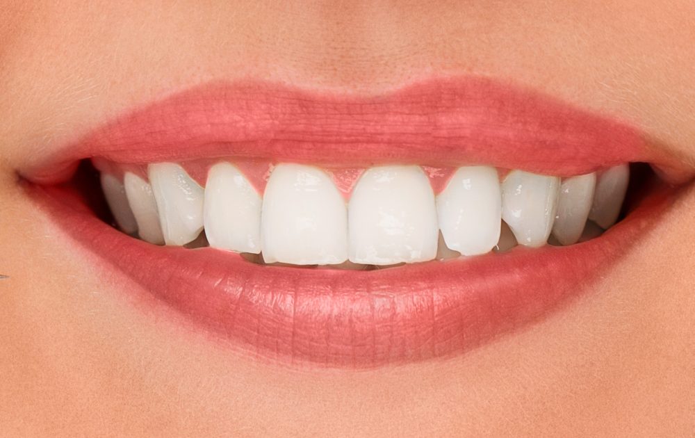 At a dentist with a smile